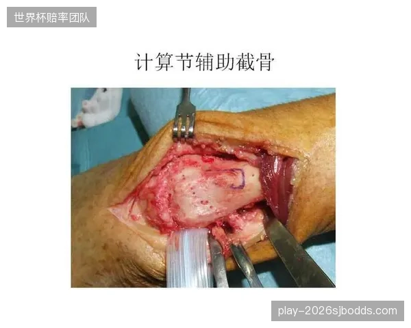 带复健资质的室内单车下探至社区中心分摊三甲骨科排队负荷